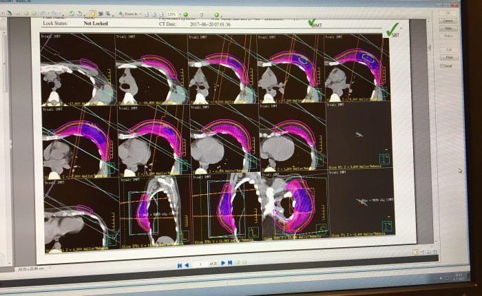38. Phase 3 – getting geeky about&nbsp;radiotherapy
